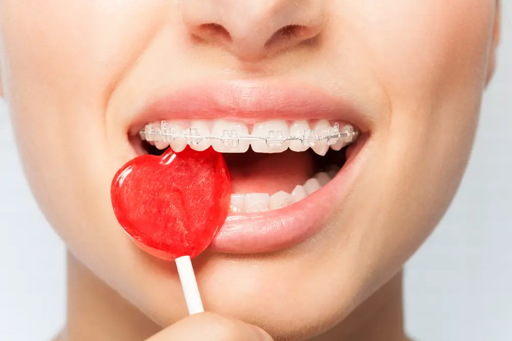 Woman with metal braces biting into red heart lollipop